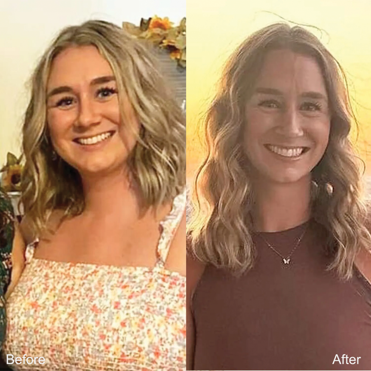 Metabolix patient confident after weight loss